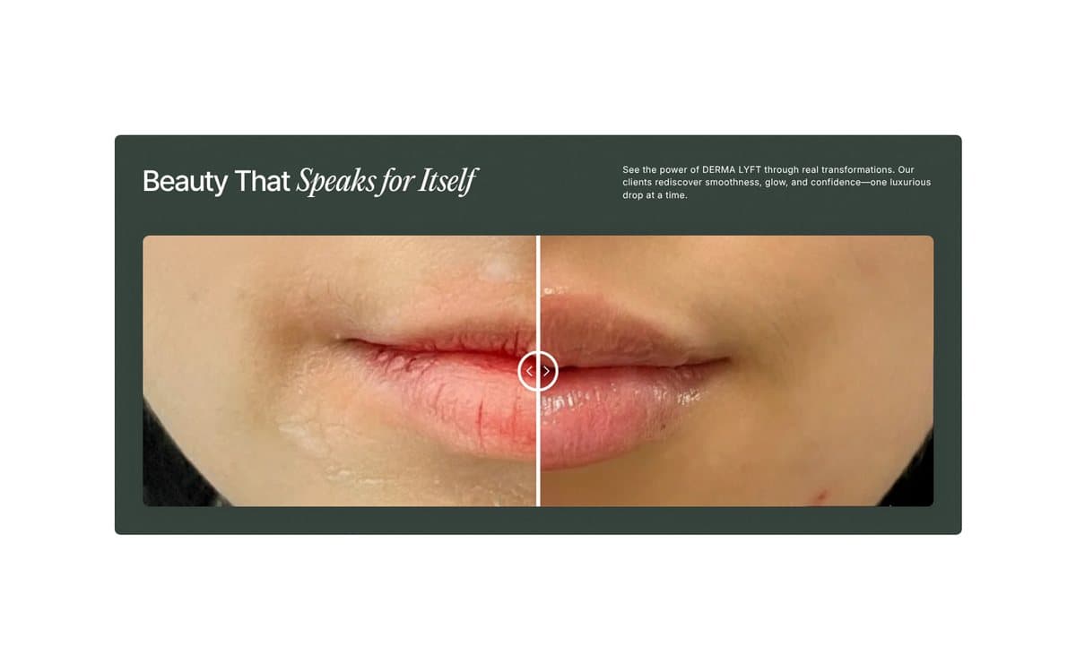 Dermalyft: An interactive before-and-after slider
